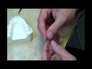 Fast Splint Matrix - Attelle de Rétention Linguale Orthodontique: Méthode Indirecte