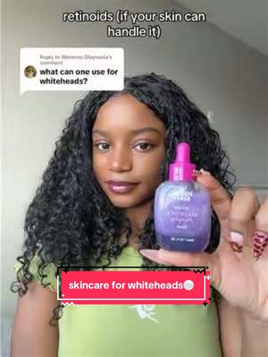 Skincare Tips for Whiteheads: Product Recommendations