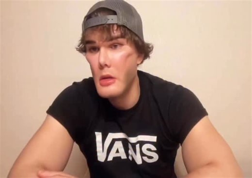 mehlmanmedical.com | “What does USMLE want for A-a gradient questions?” #mehlman_medical #mike_mehlman #usmle #usmlestep #usmleprep #usmlestep1 #usmlestep2... | Instagram