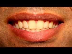 Making an Electric Toothbrush (Speed Control of a DC Motor)