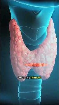 Total Thyroidectomy Procedure Explained| #Thyroidectomy #EndocrineSurgery #MedicalShorts