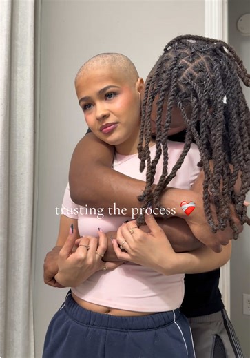 hair or no hair I’m still me 🤍 #chemohairloss #ovariancancer #cancersucks #chemotherapysideeffects #ovariancancerawareness