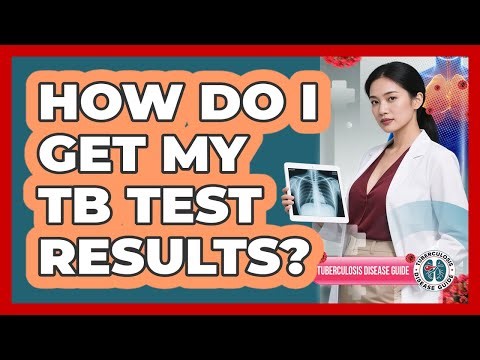How Do I Get My TB Test Results?