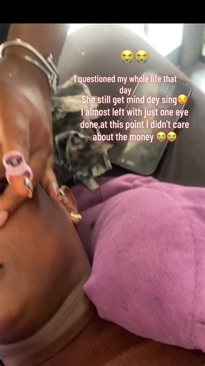 My Painful Microblading Experience