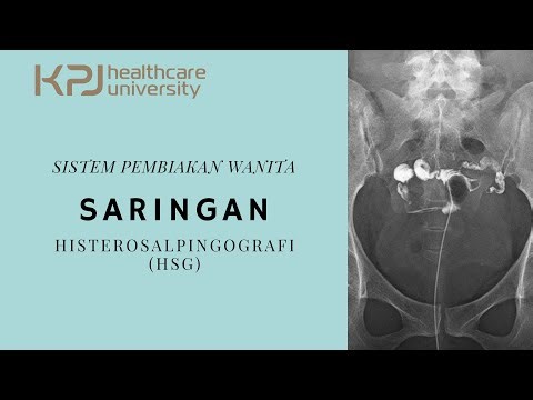 Hysterosalpingography Procedure