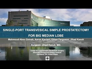 Single-Port Transvesical Simple Prostatectomy For Big Median Lobe (Graphic)