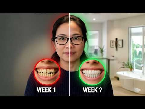 Why do we have crooked teeth?