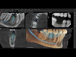 Ten @ 10 – DEXIS DTX Studio™ Clinic: A New Era of Smart Dental Imaging