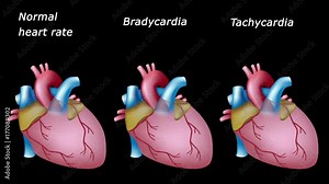 Sinus bradycardia and tachycardia: normal and pathological heart rates, loopable animation.