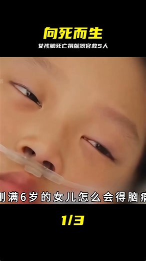 女兒突發腦死亡，父母含淚捐獻全身器官，她一人救活五個家庭 #器官捐献，感动瞬间，真实案例，生命延续，大爱无疆