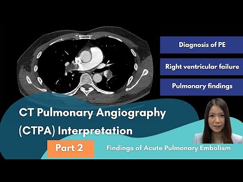 Findings of Acute Pulmonary Embolism - CTPA Interpretation Part 2