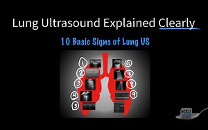 Lung Ultrasound Explained Clearly - Video Transcript - Medcram Blog