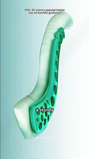 Broken Collarbone Treatment Explained - 3d Animation.