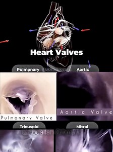 Understanding the Four Heart Valves