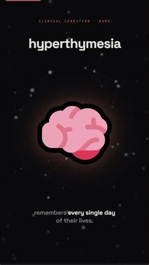 Memory - A Curse 🧠 #psychology #shorts