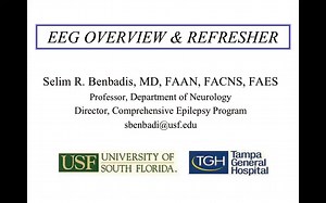 EEG U | EEG Refresher Show & Tell