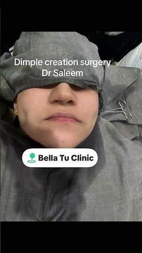 Dimple creation surgery before & after