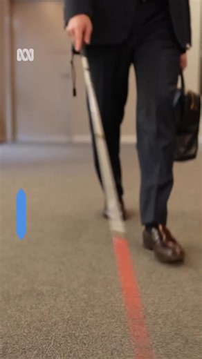 35K views · 527 reactions | The way many people view disability...