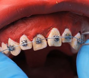 31K views · 31 reactions | Im Zahnarztstuhl! Wie gängige zahnärztliche Verfahren funktionieren! | 5-Minuten Tricks | Facebook