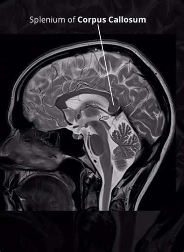 brain mri #3d #anatomy #medical #science #humanskull