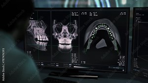 Medical x-ray software studying the condition of patients teeth. Medical x-ray software inspecting the mouth cavity. Medical x-ray software used for dental treatment at a hospital. Orthodontics.