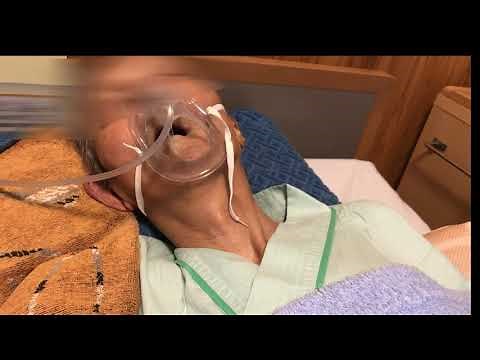 死戦期呼吸 下顎呼吸 死ぬ間際の呼吸 agonal gasp. agonal respiretion 死直前３０分前の呼吸 下顎呼吸