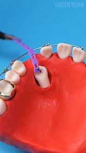 It looked impossible… until he did this | Green Bean