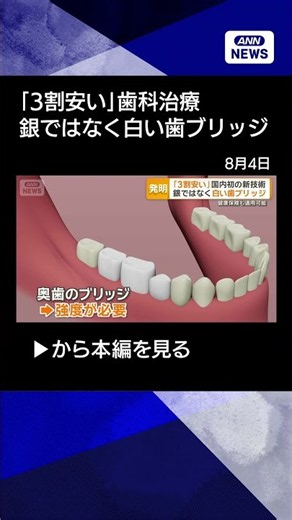 【ニュース】保険適用、歯科治療の白い新素材は割安 耐久性は金属並み、ブリッジに選ぶ患者増える【もっと知りたい！】【グッド！モーニング】(2026年8月3日) #shorts