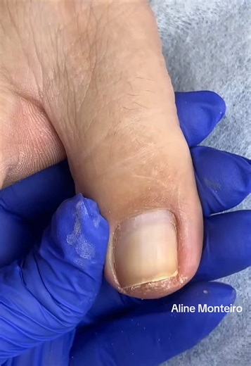 Transformação maravilhosa 💅😍 Esmalte : Pétala @Esmalte Colorama 🌈 Adesivo : @Art.em.maos2