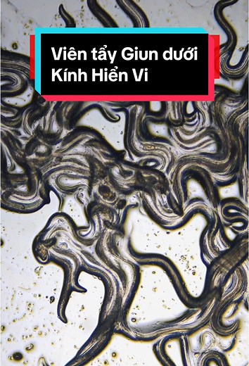Viên tẩy giun và tác dụng diệt giun hiệu quả