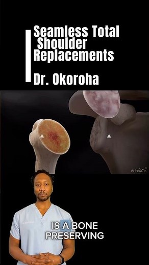 Stemless Total Shoulder Replacement: Precision in Motion! 🦾 #shorts