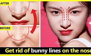 【DN.Beauty Natural】4分钟按摩改善鼻纹，摆脱鼻梁皱纹