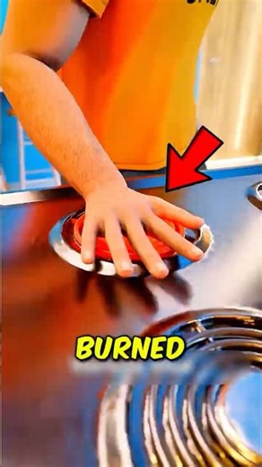 Burned Your Hand 😳 Don’t Put Ice On It!