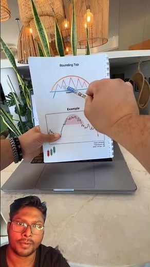 Rounding top chart pattern trading #chartanlysis #technicalanalysis