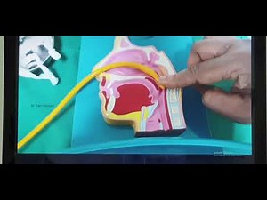 Nose bleed Part 6 (Tamil) Patient teaching programme Different techniques of posterior nasal packing