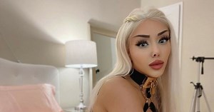 Modelka nie chce już operacji plastycznych! Jak wygląda dziś?