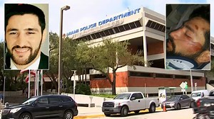 Ex-MMA Fighter Severely Injured After Alleged Brawl With Miami Cops