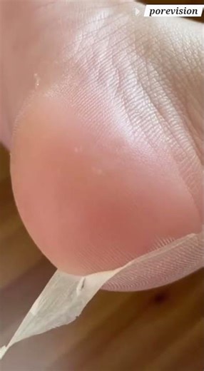 This Foot Peel Mask RIPPED Off My Dead Skin! Extreme Results