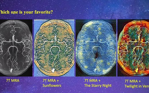 深度学习让世界名画和7T MRI图像完美融合