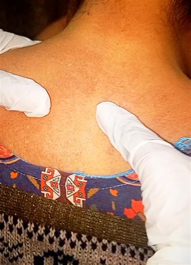 Must try these massage techniques to relieve muscle spasm #physiotherapy #fyp #viral #trending