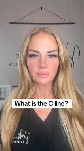 Holly Louise | Advanced Aesthetics Practitioner | Surrey on Instagram: "In facial anatomy and aesthetic medicine, the Line of Convergence (also known as the C-line) is a horizontal landmark on the forehead where two opposing movements of the frontalis muscle meet. #aesthetics #antiaging #fyp #trendingreels #skincare"