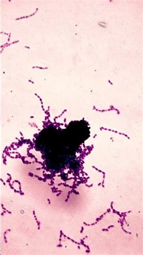 Your candy has a "Secret Partner." Read how it melts your teeth! 👇🍭 #microbiology #microscopy