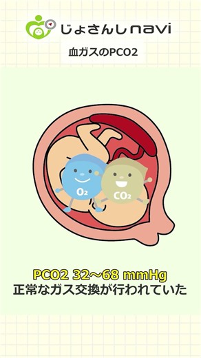 [Baby's SOS] Are you only looking at pH? Understanding umbilical cord blood gas from "PCO2"
