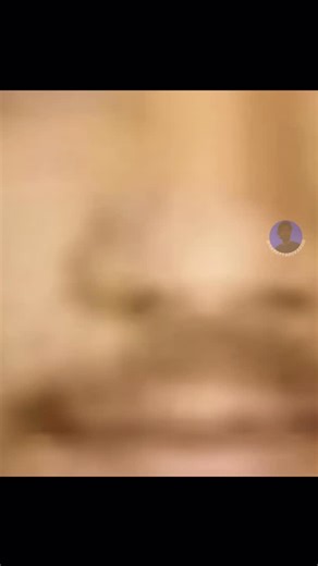 Harry Yaduvanshi on Instagram: "Kamal Dhyani, 25, died after his bike fell into a deep, open sewer pit in Janakpuri—no barricades, no warning signs, no guard, as per the FIR. He made a last call at 11:30 pm saying he’d be home in 10–15 minutes. He never arrived. His body was found the next morning. A DJB sub-contractor has since been arrested. This wasn’t bad luck. This was negligence. When a public road hides a 14–15 ft death pit, it means safety is optional, accountability comes later, and hum