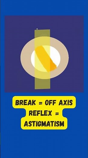 Break in Retinoscopy Reflex?