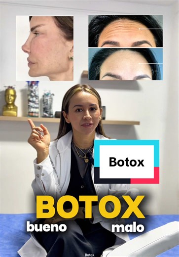¿Crees que el botox siempre te deja sin gestos? 💉Estás muy equivocado. La mayoría piensa que el botox arruina las expresiones pero en realidad, eso solo pasa cuando está mal aplicado. ✨Así se ve un botox mal hecho: cejas congeladas, sonrisa rara y cero naturalidad. ✨Y así luce un botox bien aplicado: natural, expresivo y rejuvenecido. El secreto no es evitar el botox, sino ponerte en manos de un profesional que sepa respetar tus rasgos. 👉🏻 Ahora dime ¿quieres saber las desventajas del Botox? 