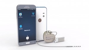 InterStim Micro SureScan launch video