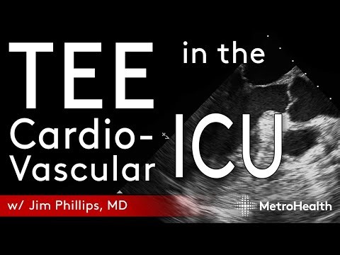 TEE in the Cardiovascular ICU