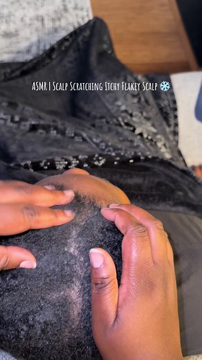 ASMR | Scalp Scratching Itchy Flakey Scalp ❄️ #asmr #scalpscratchingasmr #itchyscalp #dandruff #asmrtingles
