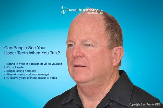 Teeth not Visible when Smiling or Talking